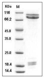Mouse E-Cadherin / CDH1 / E-cad / CD324 Protein (His Tag) SDS-PAGE