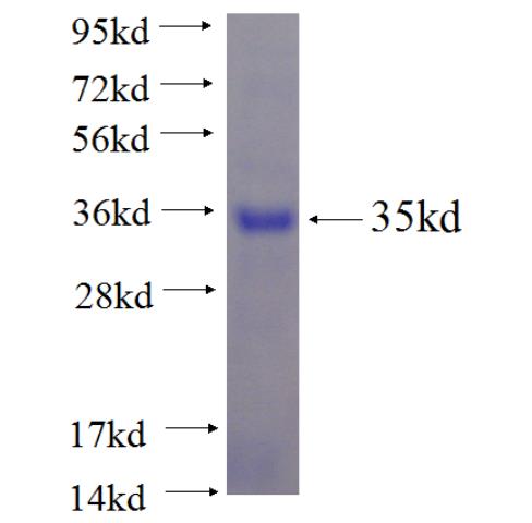 Recombinant human CCDC59 SDS-PAGE