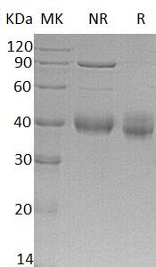 Human CRELD2/UNQ185/PRO211 (His tag) recombinant protein
