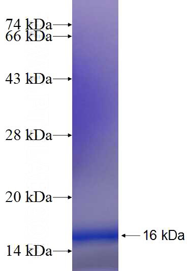 Recombinant Human ZDHHC13 SDS-PAGE