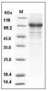 Human Vitronectin / VTN Protein (His Tag) SDS-PAGE