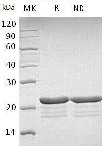 Human PPP1R14A/CPI17/PPP1INL (His tag) recombinant protein