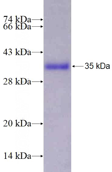 Recombinant Human TTK SDS-PAGE