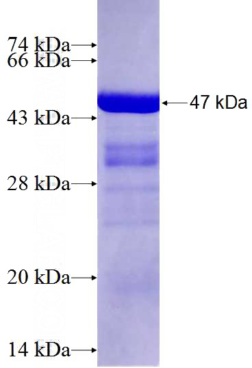 Recombinant Human MMP16 SDS-PAGE