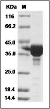 Human CEP57 / MVA2 Protein (GST Tag) SDS-PAGE