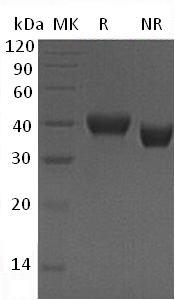 Human RNASET2/RNASE6PL (His tag) recombinant protein