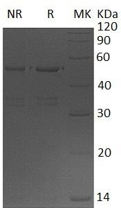 Human USP14/TGT (His tag) recombinant protein