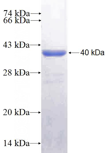 Recombinant Human HOMER2 SDS-PAGE