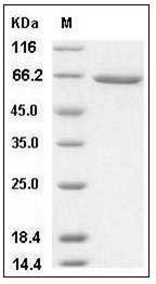 Human XRP2 / RP2 Protein (GST Tag) SDS-PAGE