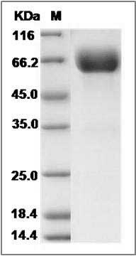 Rat Growth Hormone Receptor / GHR / GHBP Protein (Fc Tag) SDS-PAGE