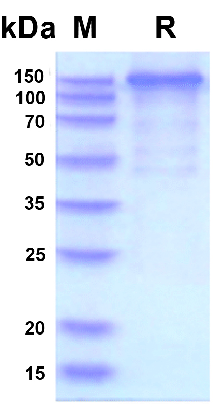 SARS-CoV-2 Spike S1+S2 ECD-His Recombinant Protein