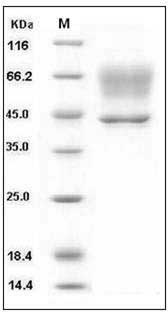 Human SerpinA3 / AACT Protein (His Tag) SDS-PAGE