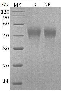 Mouse Havcr2/Tim3/Timd3 (His tag) recombinant protein
