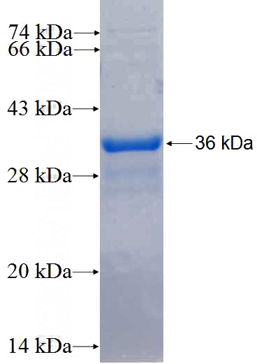 Recombinant Human TM6SF2 SDS-PAGE