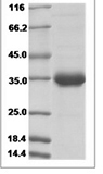 ZIKV Zikv membrane / Zikv-M Protein 15329