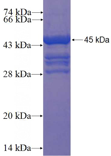 Recombinant Human SP8 SDS-PAGE