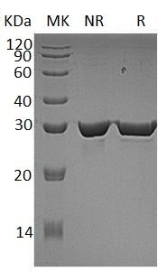 Human HPGD/PGDH1/SDR36C1 (His tag) recombinant protein