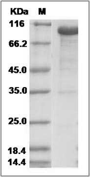 Rat DLL1 / Delta-like Protein (Fc Tag) 1 Protein (Fc Tag) SDS-PAGE