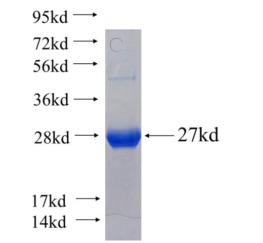 Recombinant human CHRNA7 SDS-PAGE