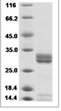 EV-D68 EV-D68 VP4 recombinant protein (C-rabbit IgG-Fc)