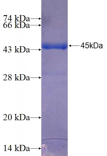 Recombinant Human LRRFIP2 SDS-PAGE