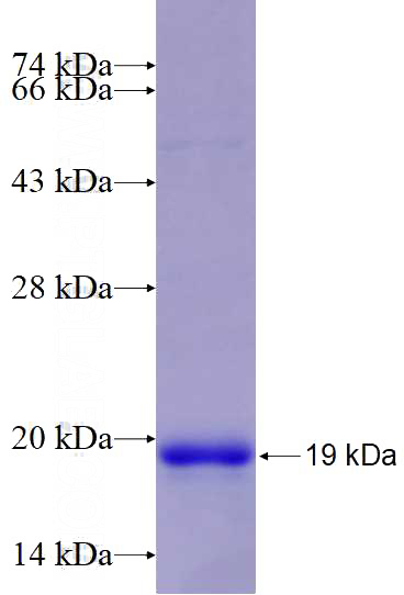 Recombinant Human PD-L1/CD274 SDS-PAGE