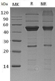 Human ATG4A/APG4A/AUTL2 (His tag) recombinant protein