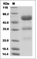 Rat EphA2 / Eph Receptor A2 Protein (Fc Tag)