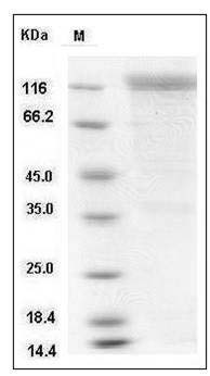 Mouse HER2 / ErbB2 Protein (Fc Tag) SDS-PAGE