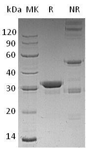 Human GZMA/CTLA3/HFSP (His tag) recombinant protein