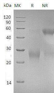 Human CDK2AP2/DOC1R (His tag) recombinant protein