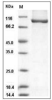 Human AGO3 / Argonaute 3 / EIF2C3 Protein (His Tag) SDS-PAGE