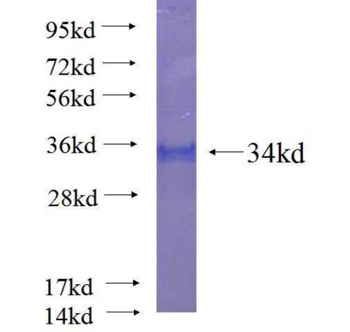 Recombinant human SPRR2A SDS-PAGE