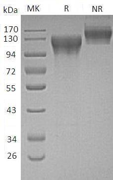 Human ECE1 (His tag) recombinant protein