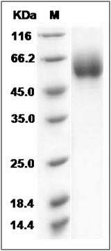Rat SLC3A2 / CD98 Protein (His Tag) SDS-PAGE