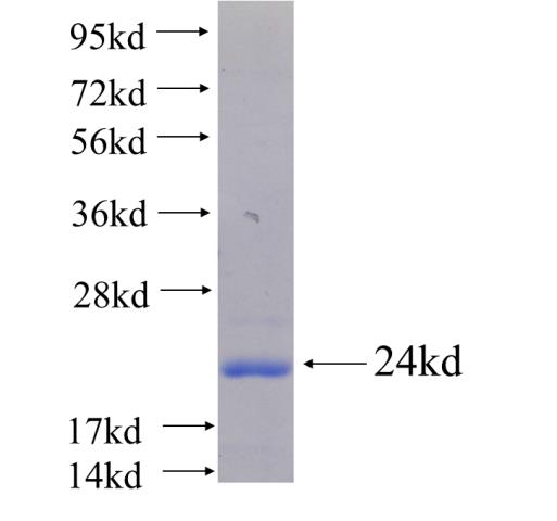 Recombinant human SNED1 SDS-PAGE