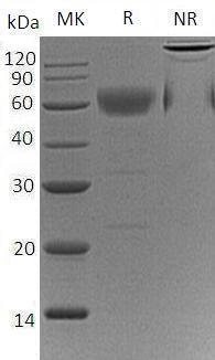 Human GALNT3 (His tag) recombinant protein