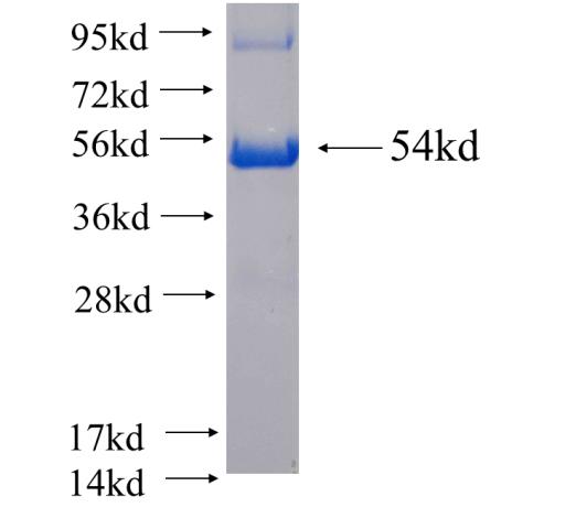 Recombinant human DHRS11 SDS-PAGE