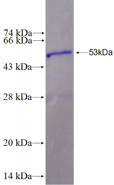 Recombinant Human CCDC57 SDS-PAGE