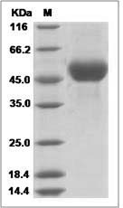 Influenza A H11N6 (A/duck/England/1/1956) Hemagglutinin / HA Protein (His Tag)