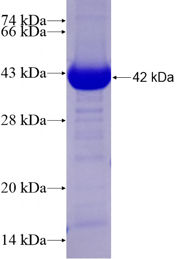 Recombinant Human STBD1 SDS-PAGE
