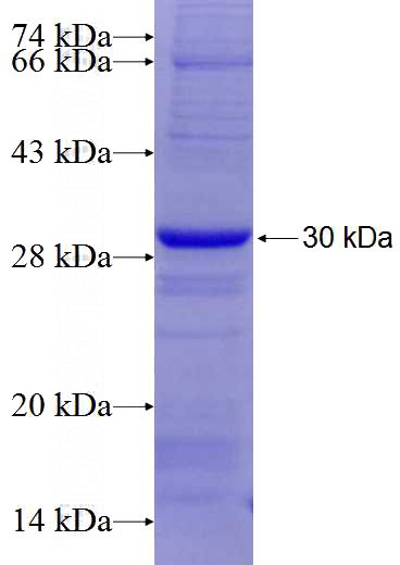 Human Integrin alpha-6 Recombinant protein (6*His tag)