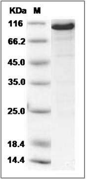 Human CASK Kinase Protein SDS-PAGE