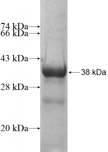 Recombinant Human DHRSX SDS-PAGE
