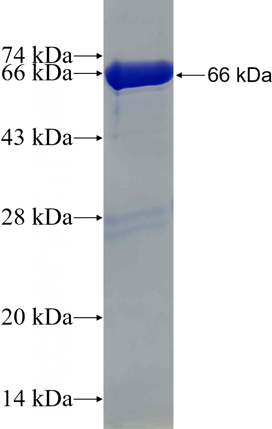 Recombinant Human ATP6V1C1 SDS-PAGE