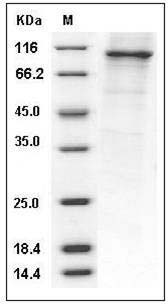 Human PDE4B / DPDE4 Protein (His & GST Tag) SDS-PAGE