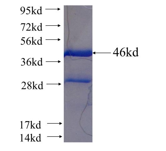 Recombinant human CETN1 SDS-PAGE