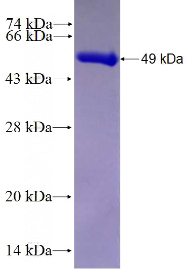 Recombinant Human ATP1A3 SDS-PAGE
