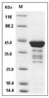 Human C1D Protein (GST Tag) SDS-PAGE