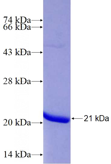 Recombinant Human SRP14 SDS-PAGE